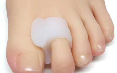 toe separators work for overlapping toes