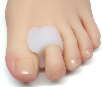 toe separators work for overlapping toes